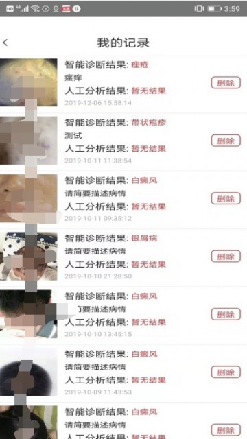 皮肤病拍照自测