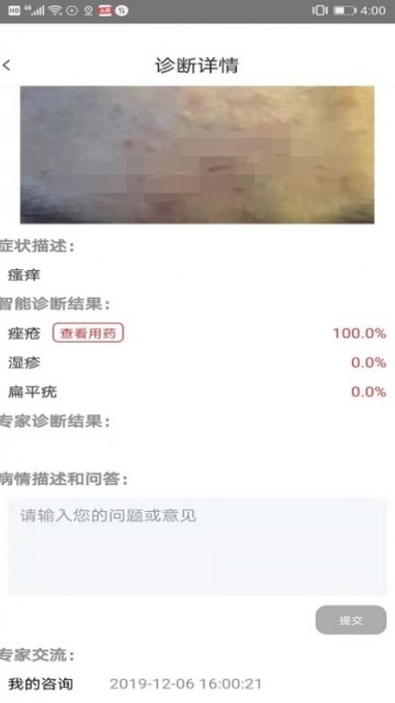 皮肤病拍照自测