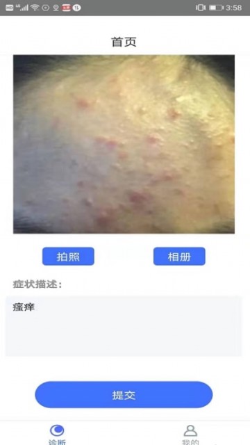 皮肤病拍照自测